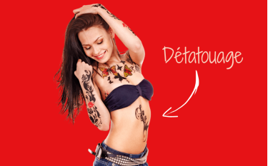 detatouage
